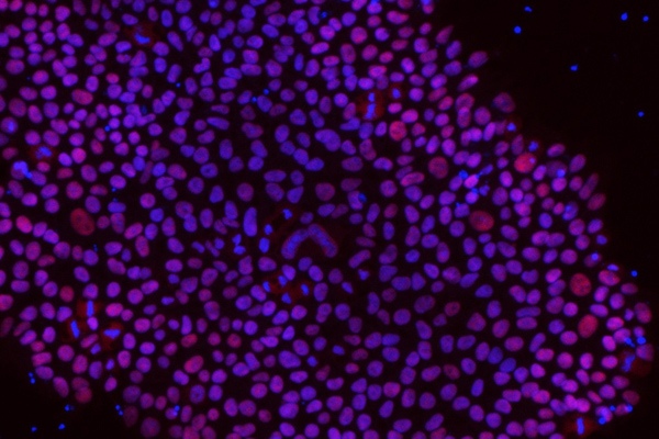 你听过“超级捐献者”细胞吗，干细胞研究能否因此东山再