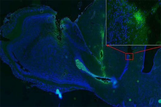 Stem Cell Rep：中美科学家成功利用电场引导神经干细胞治疗脑