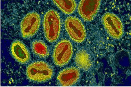Science：人工让灭绝的马痘病毒复活，或引发重大的生物学安