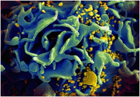开发出靶向HIV病毒库的Dual-CAR-T细胞，为治愈HIV感染奠定基础