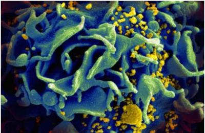 开发出靶向HIV病毒库的Dual-CAR-T细胞，为治愈HIV感染奠定基础